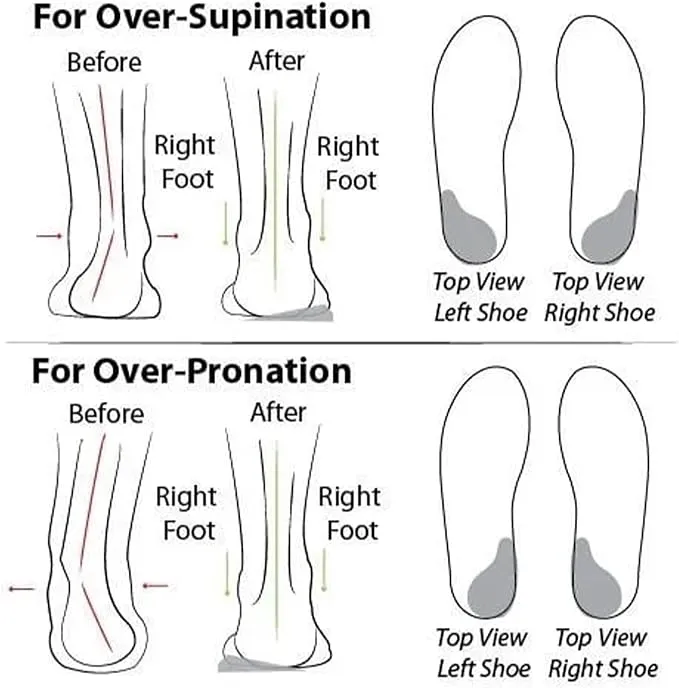 New Air Cushion Pain Relief Orthopedic Shoes for The Elderly, Breathable with Arch Support Mesh Casual Shoes Grey Sz 8.5
